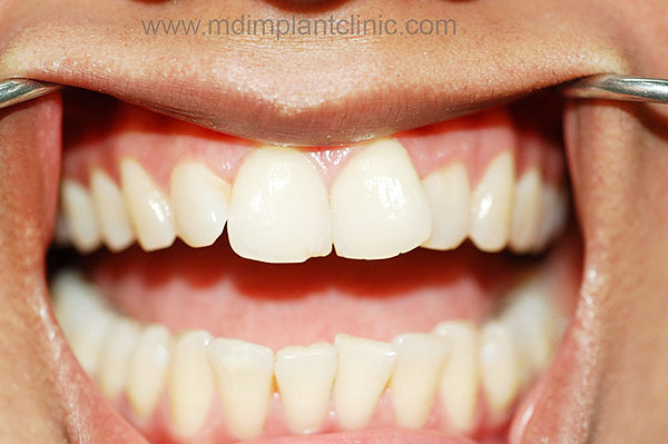 Mother Dental Implant Clinic