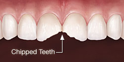 Mother Dental Implant Clinic