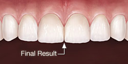 Mother Dental Implant Clinic