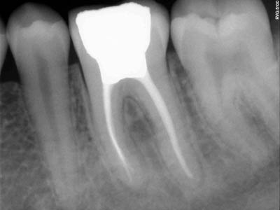 Mother Dental Implant Clinic